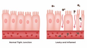 bpc-157 leaky gut or intestinal permeability Gut permeability & IBS - do I really have a 'leaky' gut?